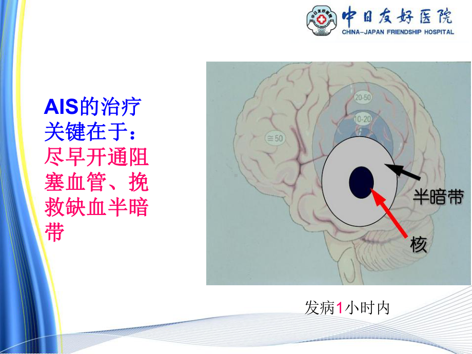 医学静脉溶栓的护理培训课件.ppt_第3页