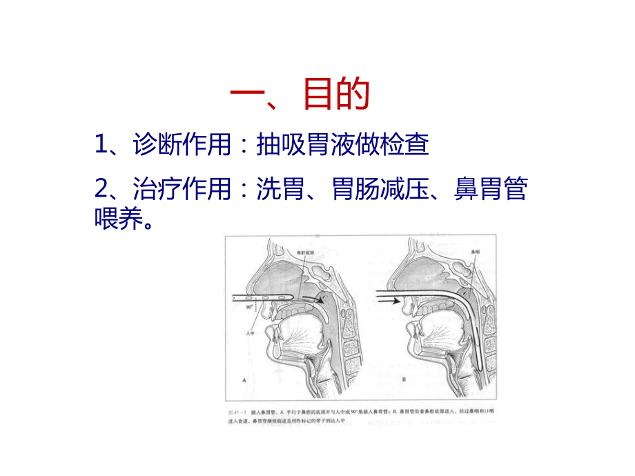 小儿胃管置入术-医学课件.ppt_第3页