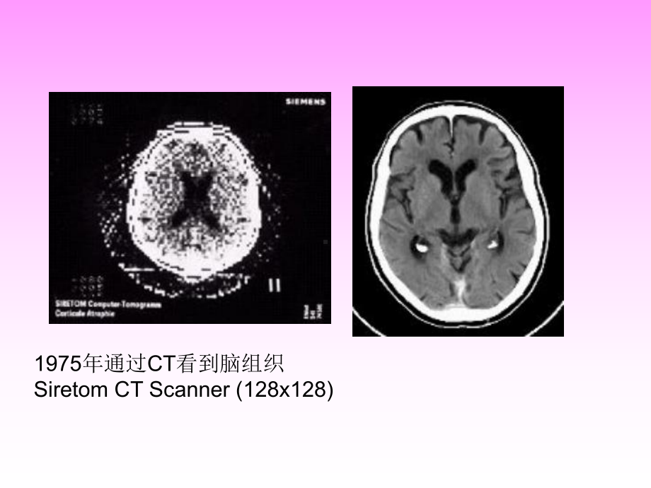 头颅CT基本知识及常见疾病课件.ppt_第3页