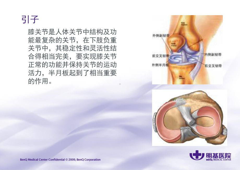 半月板损伤及护理-课件.ppt_第2页