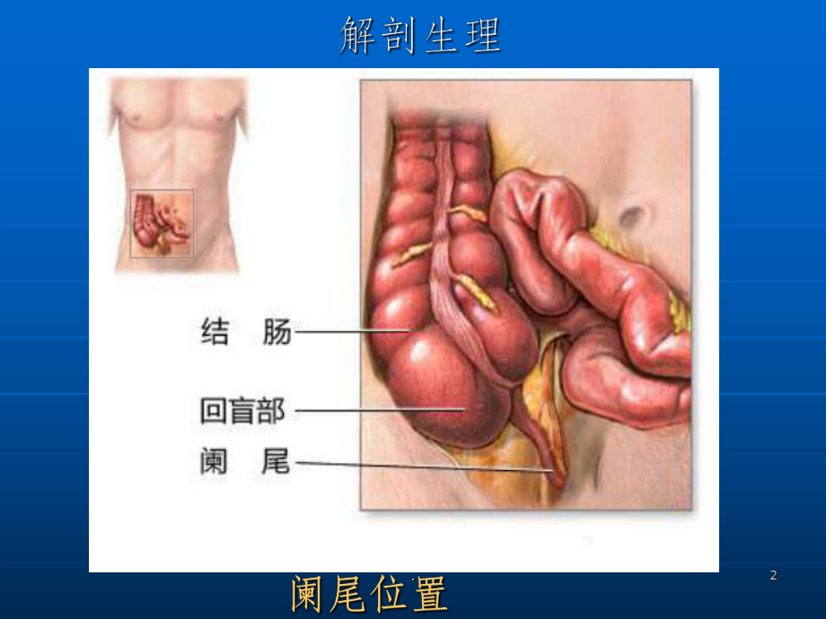 外科学(阑尾炎)课件.ppt_第2页