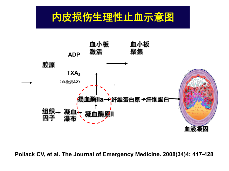 医学凝血功能障碍患者麻醉处理流程培训课件.ppt_第3页