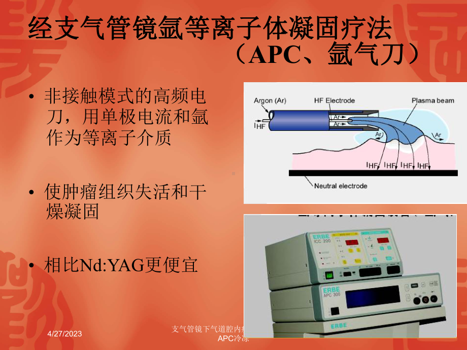 支气管镜下气道腔内疾病的介入治疗APC冷冻培训课课件.ppt_第3页