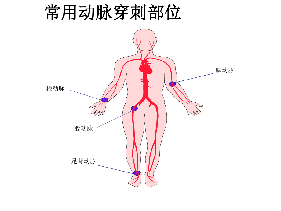 如何抽取动脉血课件.ppt_第2页