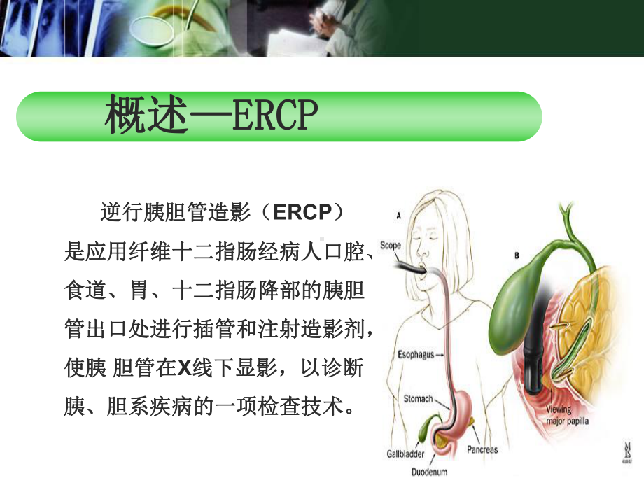 医学课件-ERCP及术前术后护理教学课件.ppt_第3页