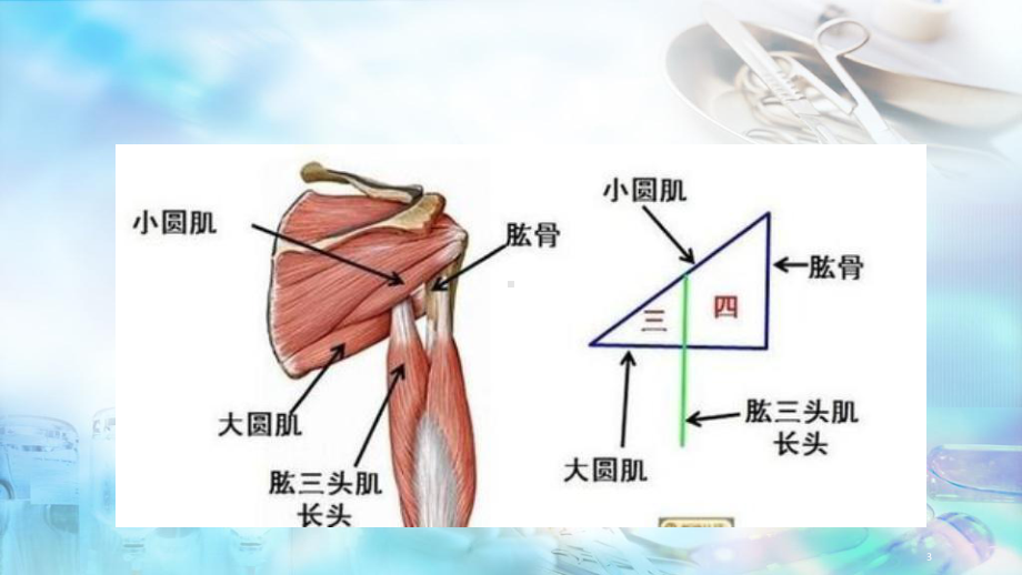 医学课件-四边孔综合症教学课件.pptx_第3页