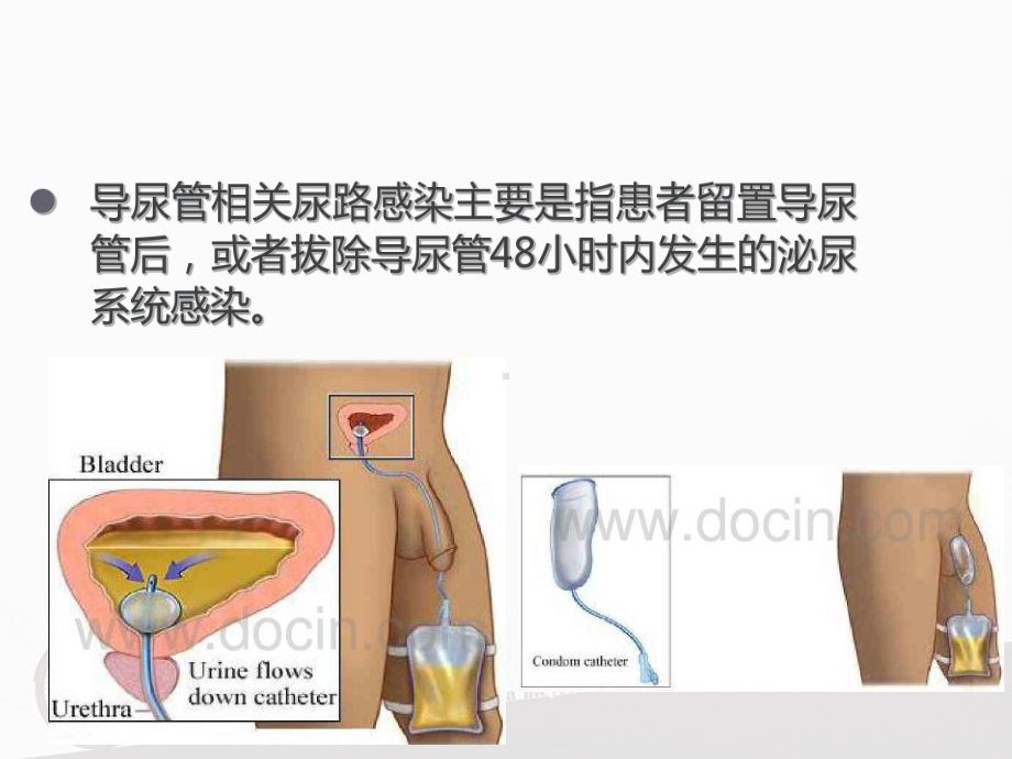 导尿管相关尿路感染的预防-课件.ppt_第3页