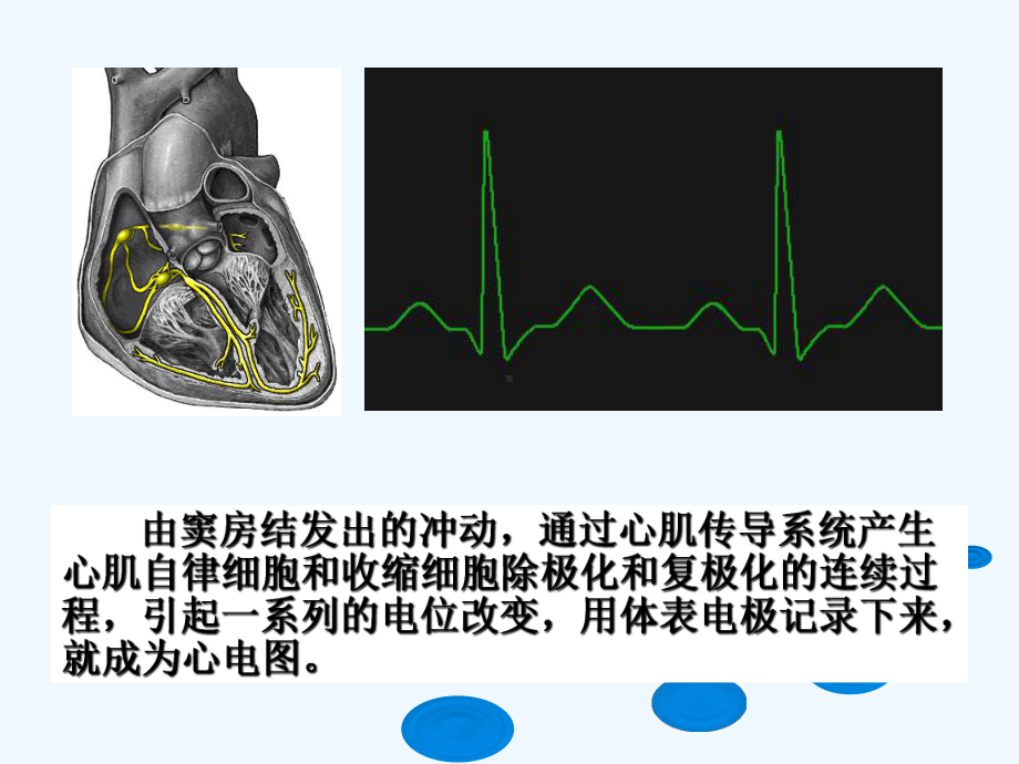 抗精神病药所致QTc间期延长、TdP和猝死课件.ppt_第3页