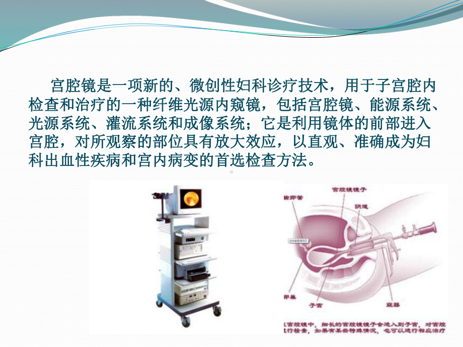 宫腔镜教学讲解课件.pptx_第2页