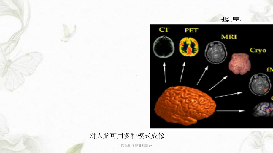 医学图像配准和融合课件.ppt_第3页