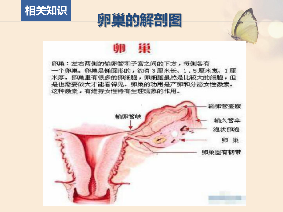 卵巢囊肿患者的护理查房(同名204)课件.ppt_第3页