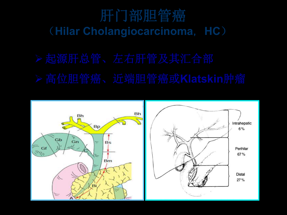 医学肝门部胆管癌诊断治疗指南解读专题培训课课件.ppt_第3页