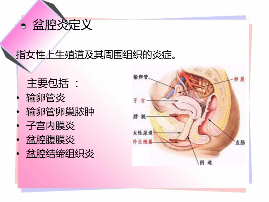 急慢性盆腔炎课件.ppt_第2页