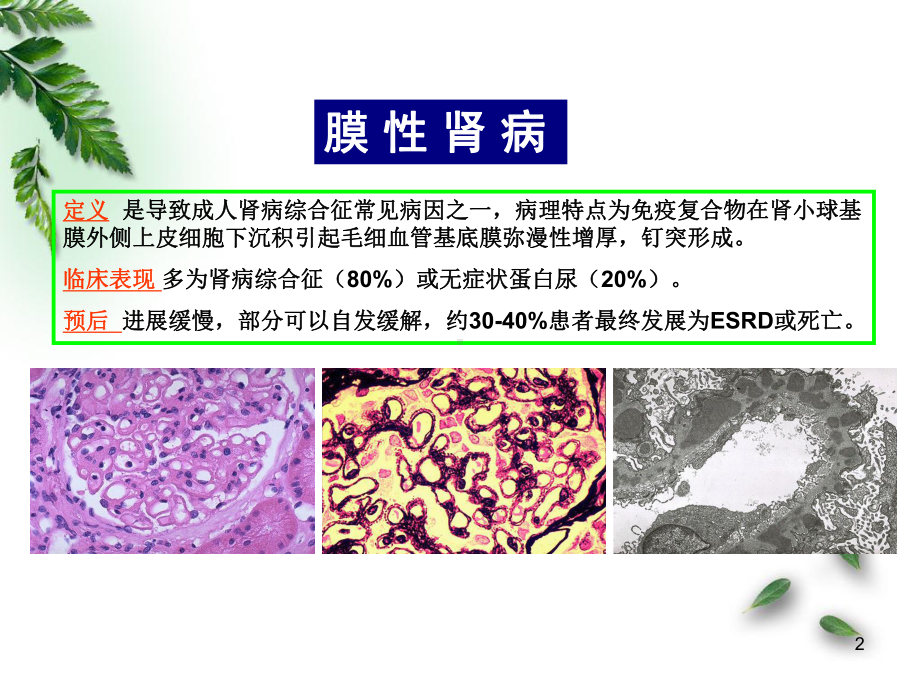 医学课件-KDIQO指南解读-膜性肾病治疗P.ppt_第2页