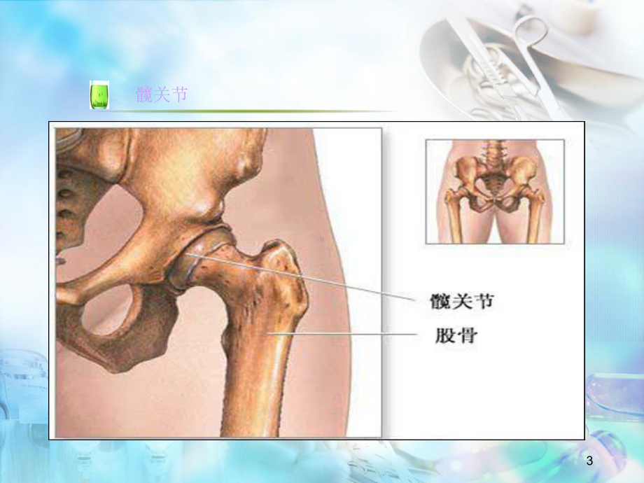 医学课件-髋关节置换术后护理教学课件.ppt_第3页