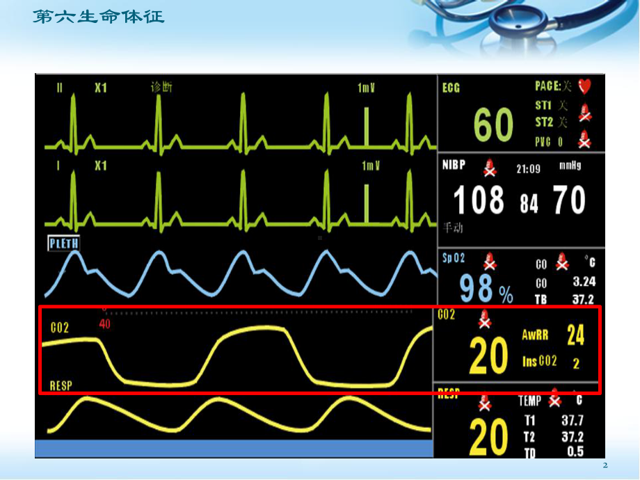 医学课件-呼气末二氧化碳分压的临床应用幻.ppt_第2页