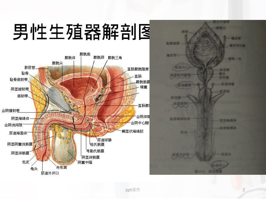 良性前列腺增生症-课件.ppt_第2页