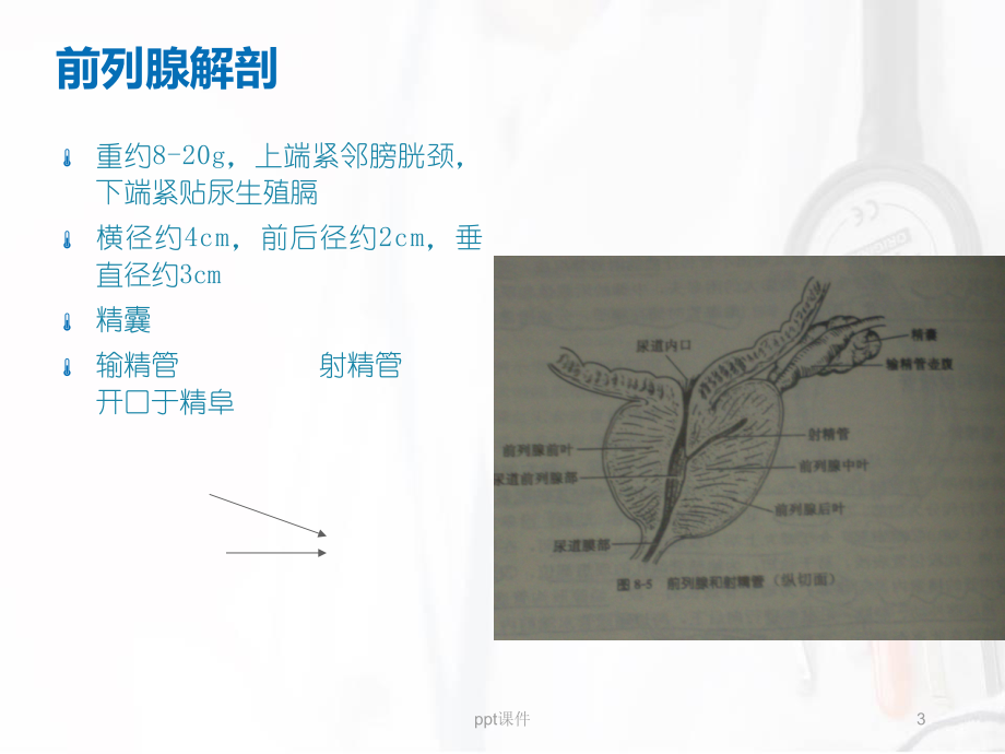 良性前列腺增生症-课件.ppt_第3页