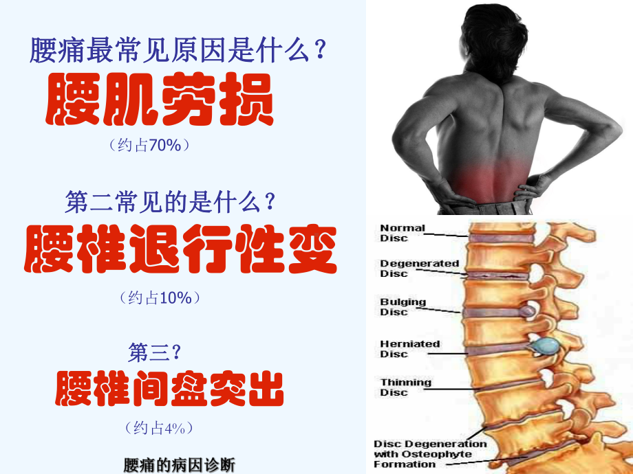 腰痛的全科管理课件.ppt_第3页