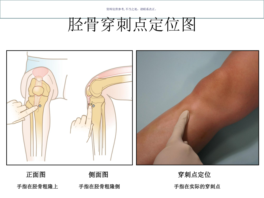 胫骨解剖结构图课件.ppt_第2页