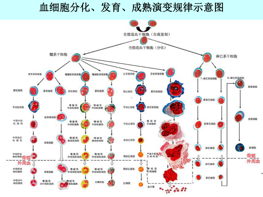 白血病-教学讲解课件.ppt_第3页