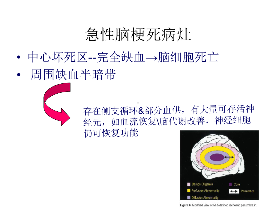 溶栓病人护理PT课件.ppt_第3页