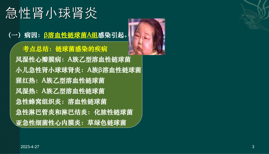 肾小球肾炎病人的护理课件讲义.ppt_第3页