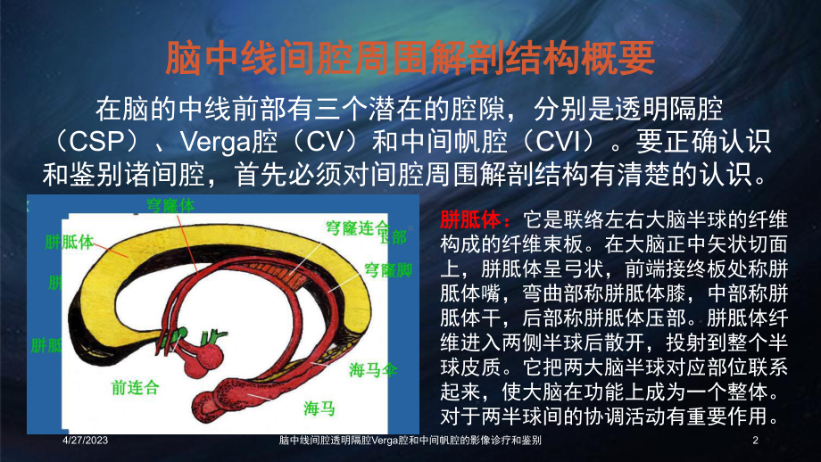 脑中线间腔透明隔腔Verga腔和中间帆腔的影像诊课件.ppt_第2页