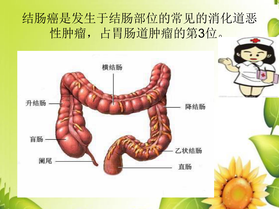 结肠癌病例讨论1课件.ppt_第3页