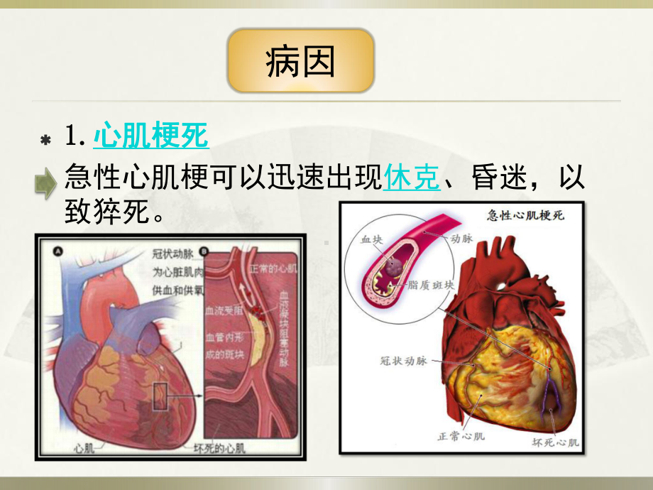 突发性猝死的应急预案及流程讲课稿课件.pptx_第3页