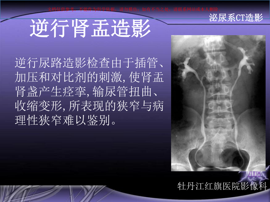 泌尿系CT造影CTU培训课件.ppt_第3页