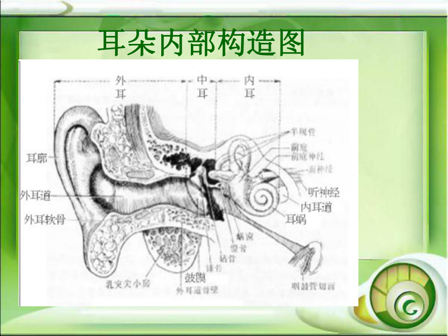 突发性耳聋的护理查房-课件1.ppt_第3页