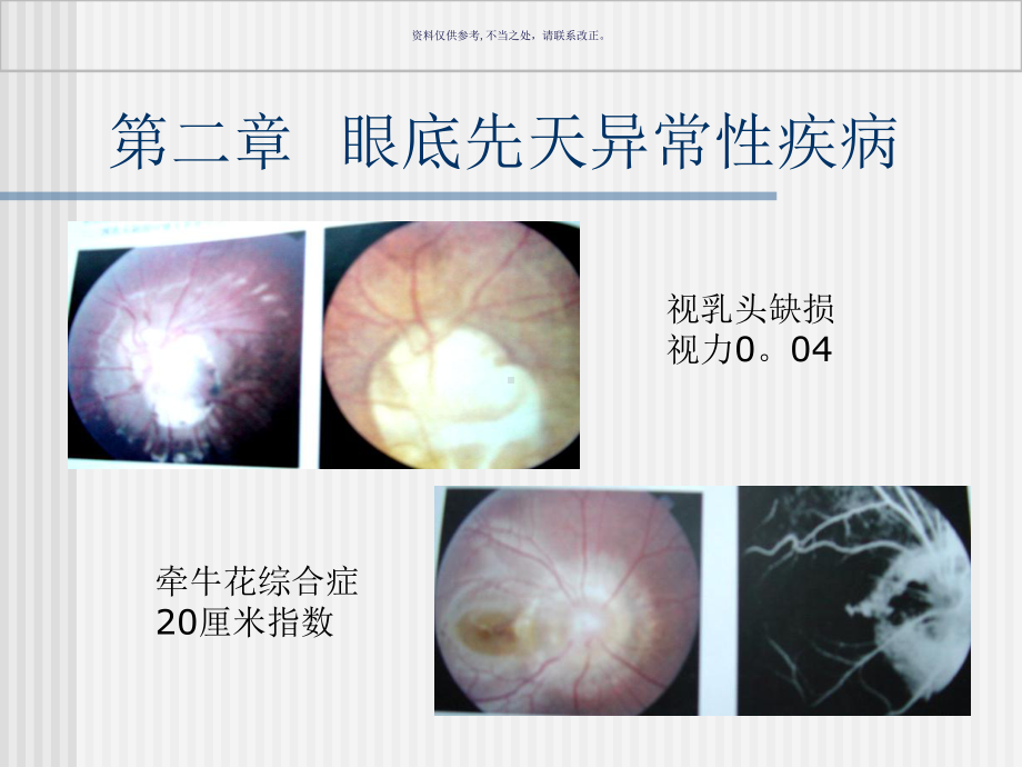 眼底病主题医学知识课件.ppt_第1页