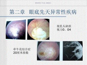 眼底病主题医学知识课件.ppt