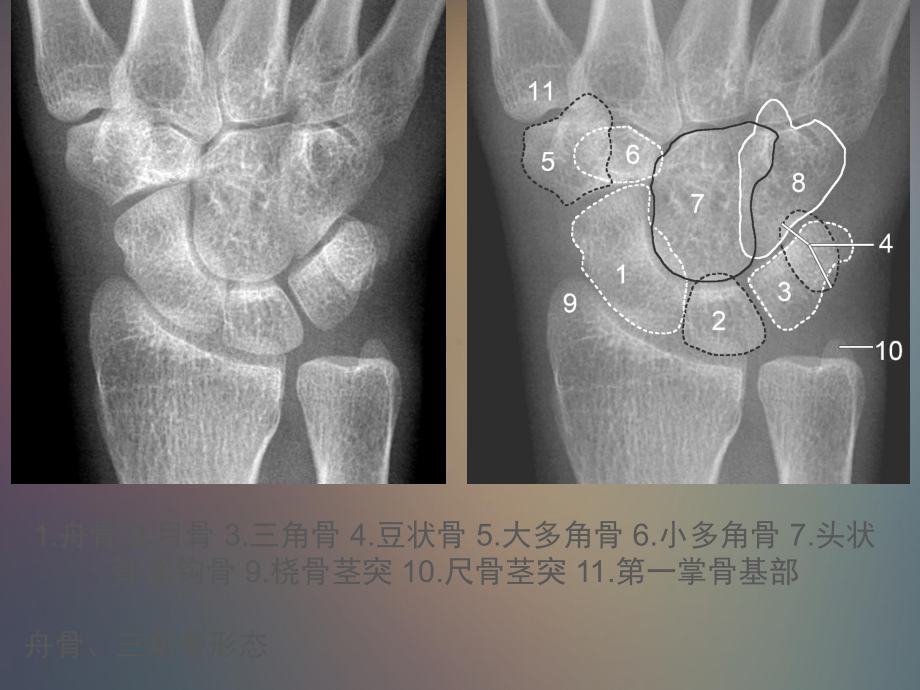 腕关节解剖课件.pptx_第2页