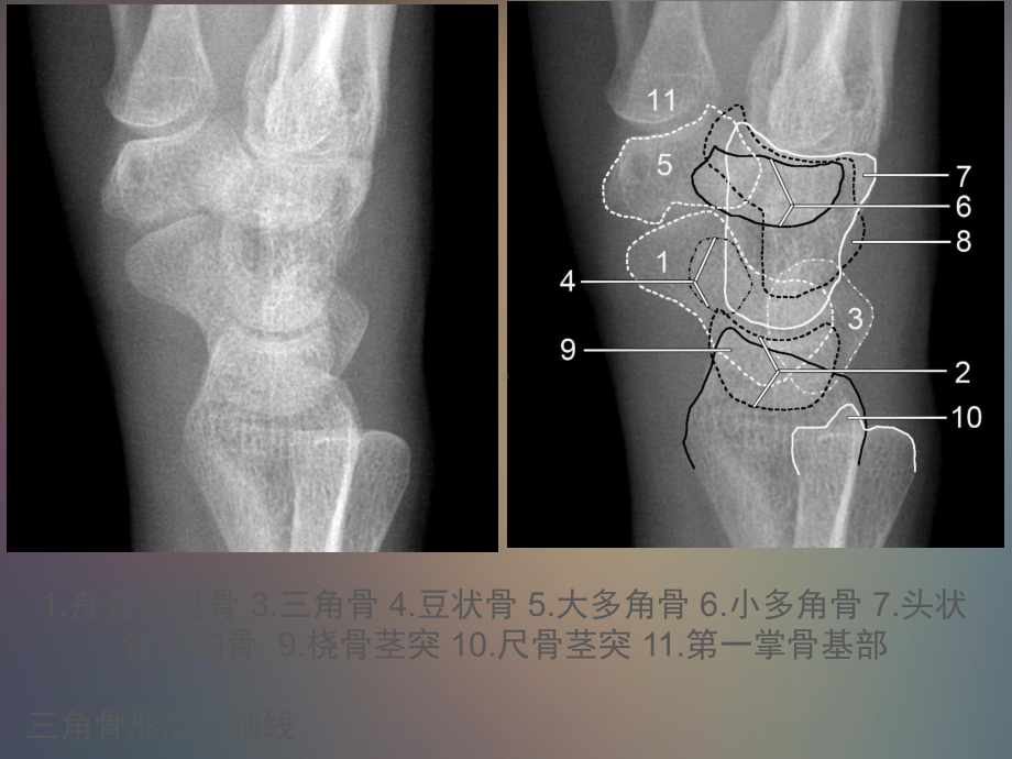 腕关节解剖课件.pptx_第3页