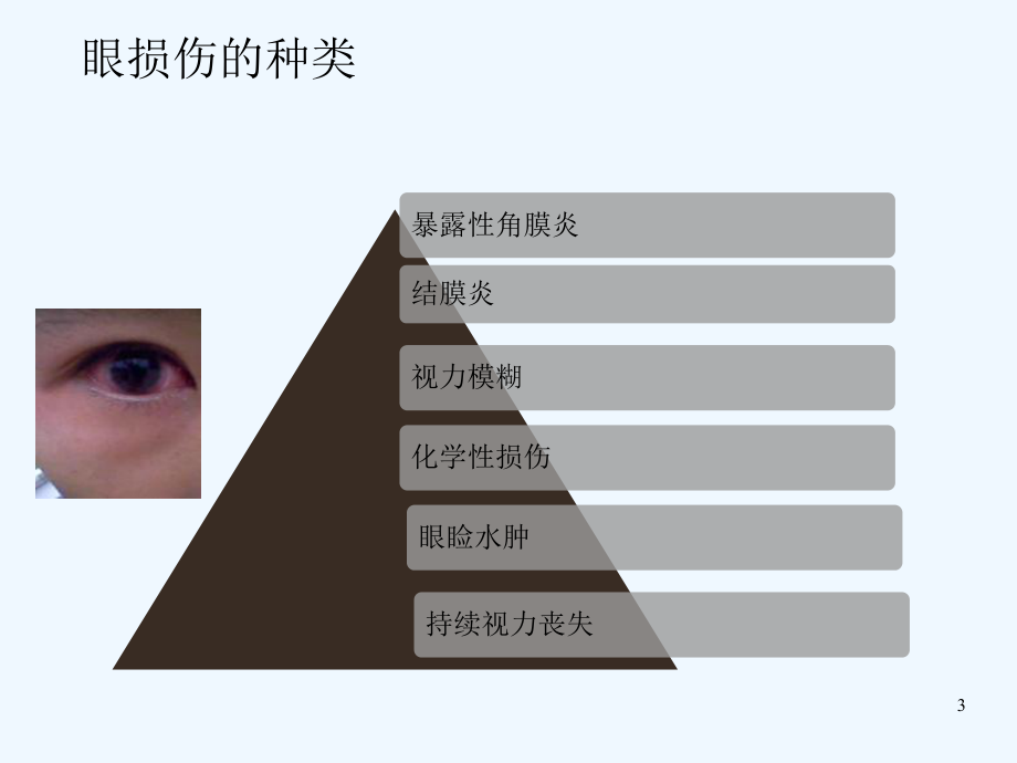 术中眼保护措施-课件.ppt_第3页