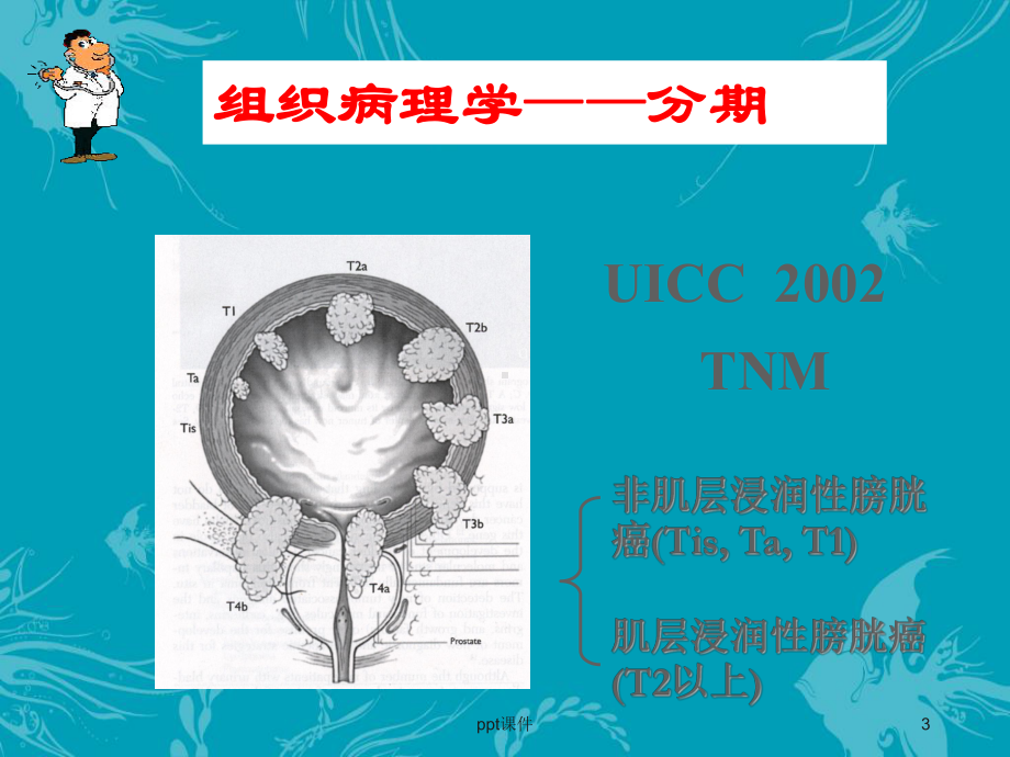 膀胱癌的化疗-课件.ppt_第3页