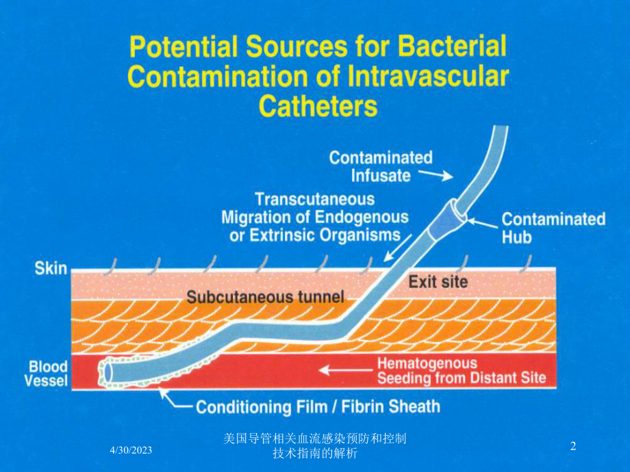 美国导管相关血流感染预防和控制技术指南的解析培训课件.ppt_第2页