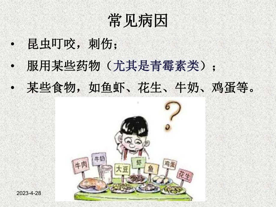 过敏性休克护理查房课件讲义.ppt_第2页