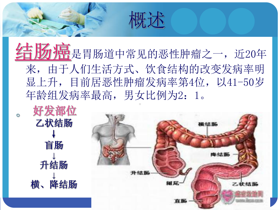 结肠癌(同名104)课件.ppt_第3页