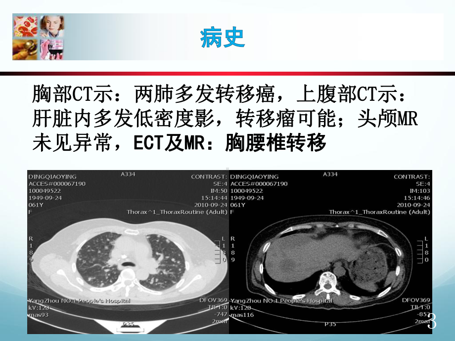 病例分享教学课件.ppt_第3页