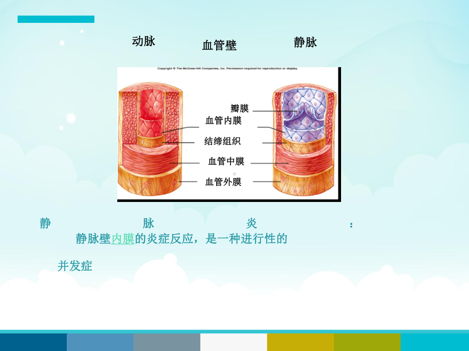 胺碘酮致静脉炎-课件.ppt_第2页