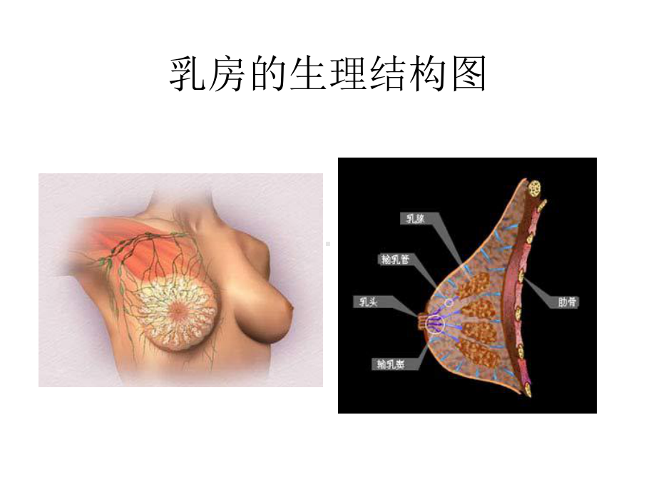 良性乳腺疾病与乳腺癌的相关性市立医院外科胡惠芳课件.ppt_第3页