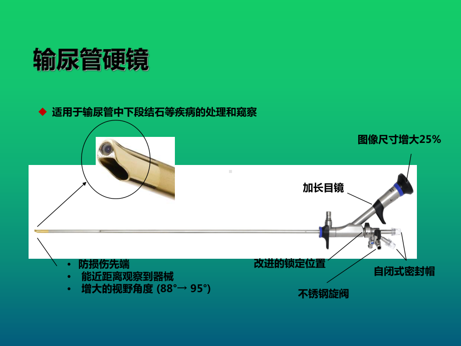 输尿管镜的临床运用课件.ppt_第3页