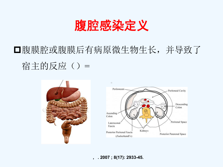 腹腔感染细菌学特点及抗生素治疗策略课件.ppt_第2页