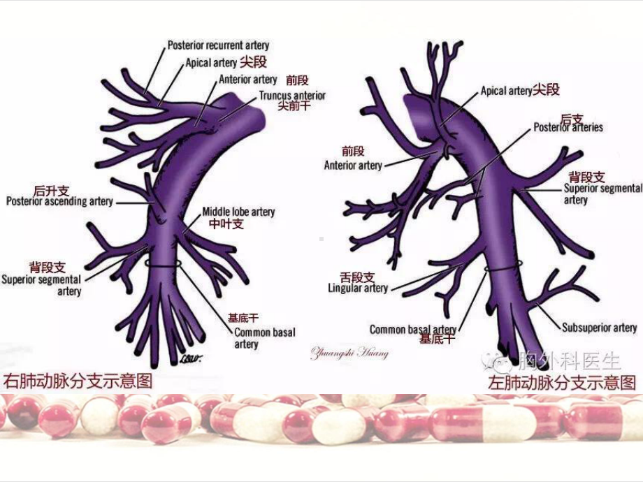 肺动脉栓塞影像表现课件.ppt_第3页