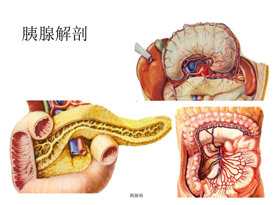 胰腺癌教学讲解课件.ppt_第2页