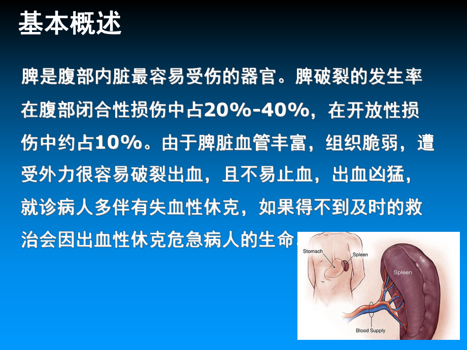 脾破裂的护理课件.ppt_第3页