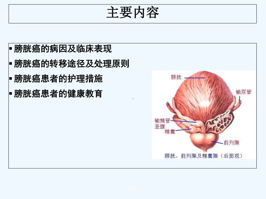 膀胱癌病人的护理及健康教育-课件.ppt_第2页